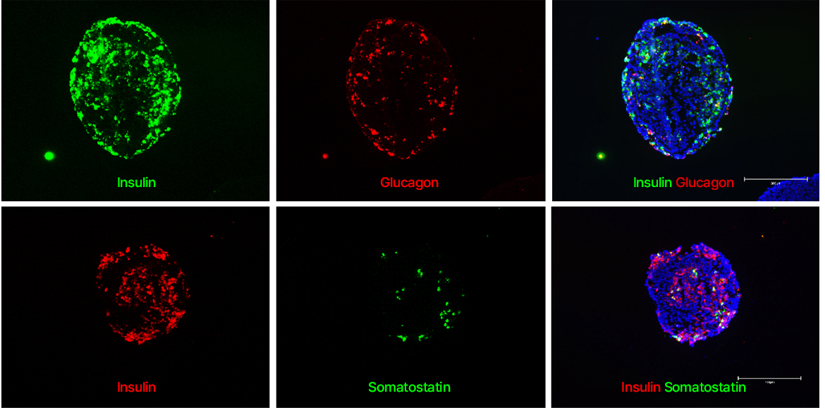 Major Hormone Expression in Islet Organoids