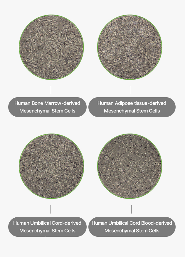 Mesenchymal stem cells cultured with KSB-3 Complete Medium® Kit