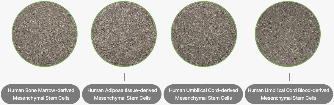 Mesenchymal stem cells cultured with KSB-3 Complete Medium® Kit