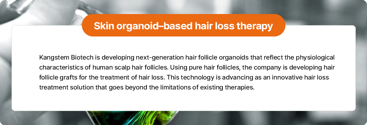 피Skin Organoid Based Hair Loss Therapy