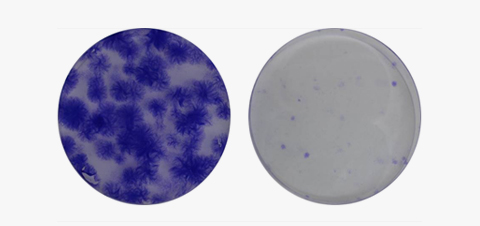 KSB-3 Complete Medium® Kit