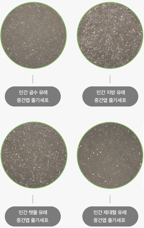 KSB-3 Complete Medium® Kit로 배양한 중간엽 줄기세포