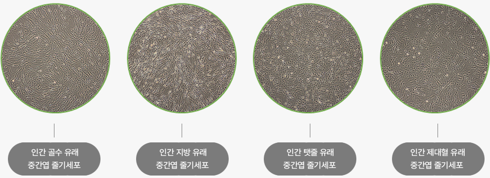 KSB-3 Complete Medium® Kit로 배양한 중간엽 줄기세포
