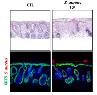 Induce Atopic Dermatitis