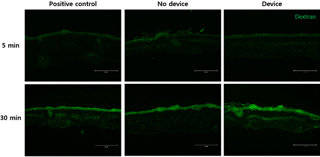 Evaluation of Skin Permeability of Cosmetic Devices