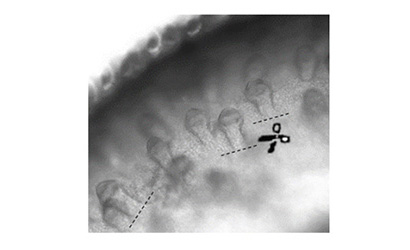 Purification of hair follicles