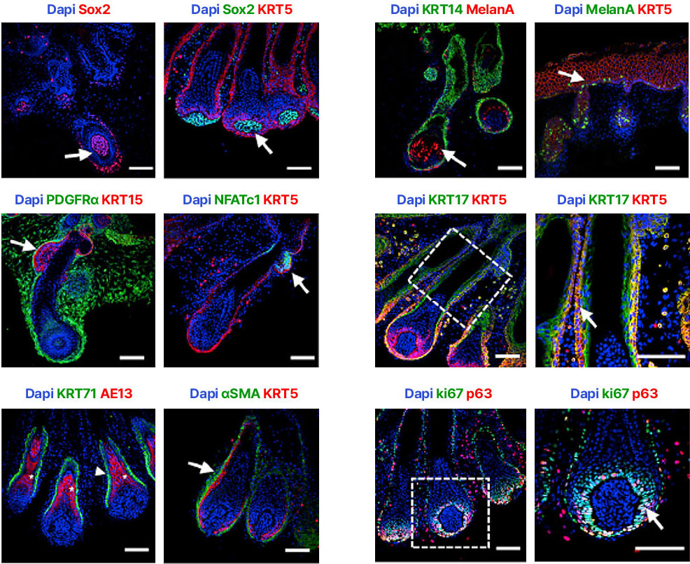 Hair follicle–focused characterization analysis